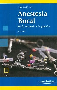 Anestesia Bucal