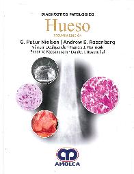 Hueso Diagnstico Patolgico