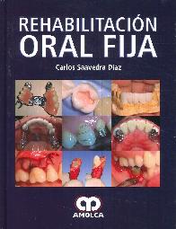 Rehabilitacin Oral Fija