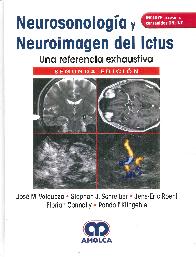 Neurosonologa y neuroimagen del ictus