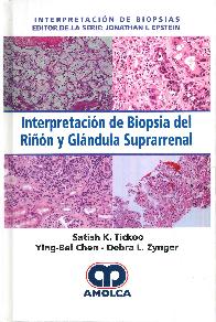 Interpretacin de Biopsia del Rin y Glndula Suprarrenal