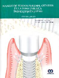 Manejo de Tejidos Periimplantarios en la Zona Esttica