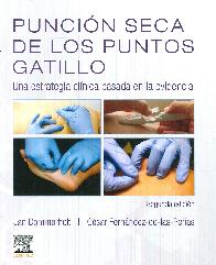 Puncin de los Puntos Gatillo
