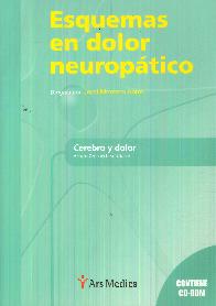 Esquemas de Dolor Neuroptico