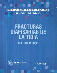 Fracturas Diafisarias de la Tibia