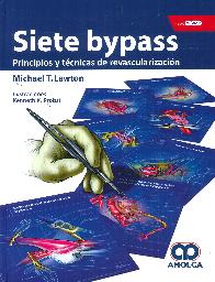 Siete Bypass