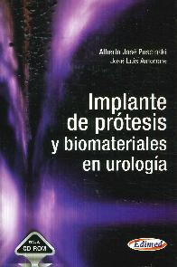 Implante de Prtesis y Biomateriales en Urologa