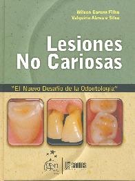 Lesiones no cariosas