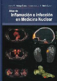 Atlas de Inflamacin en Infeccin en Medicina Nuclear
