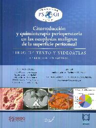 Citorreduccin y quimioterapia perioperatoria en las neoplasias malignas de la superficie peritoneal