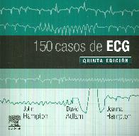 150 Casos de ECG