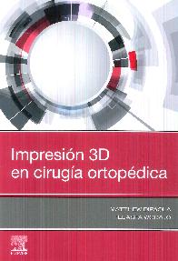 Impresin 3D en Ciruga Ortopdica