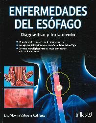 Enfermedades del esfago. Diagnstico y tratamiento