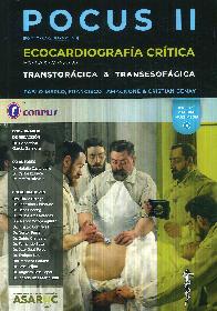 Ecocardiografa Crtica