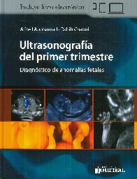 Ultrasonografa del primer trimestre