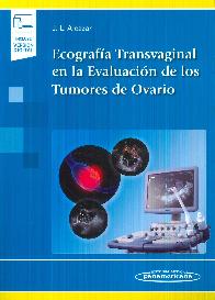 Ecografa Transvaginal en la Evaluacin de los Tumores de Ovario