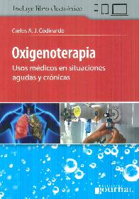 Oxigenoterapia