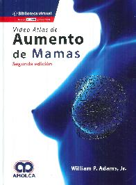 Video Atlas de Aumentos de Mamas