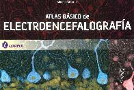 Atlas básico de electroencefalografía