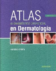 Atlas de Diagnstico Diferencial en Dermatologa