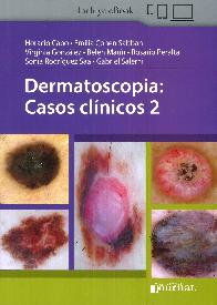 Dermatoscopia: Casos clnicos 2