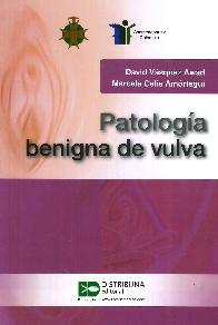 Patologa Benigna de la Vulva