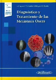 Diagnstico y Tratamiento de las Metstasis seas