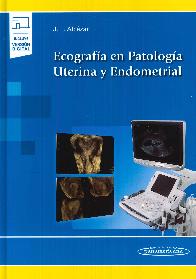 Ecografa en Patologa Uterina y Endometrial