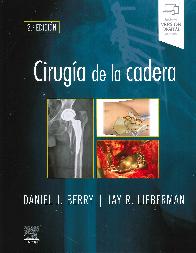 Ciruga de la cadera