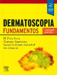 Dermatoscopia Fundamentos