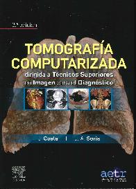 Tomografa computarizada