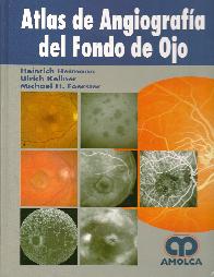 Atlas de angiografa del Fondo de Ojo