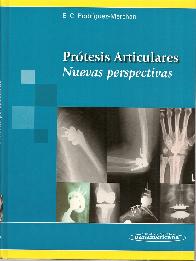 Protesis articulares