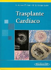 Trasplante Cardaco