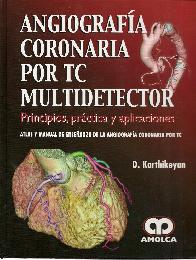 Angiografa Coronaria por TC Multidetector
