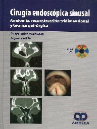 Ciruga Endoscpica Sinusal