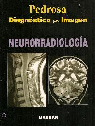Pedrosa Diagnstico por imagen Neurorradiologa