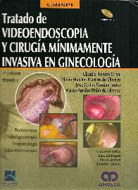 Tratado de Videoendoscopia y Cirugia Minimamente Invasiva en Ginecologia - 2 Tomos