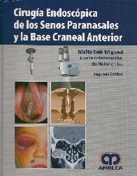 Cirugia Endoscopica de los Senos Paranasales y la Base Craneal Anterior