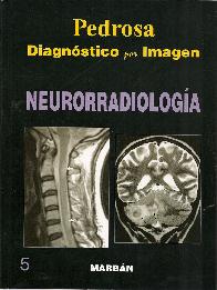 Pedrosa Diagnóstico por Imagen Neurorradiología 5