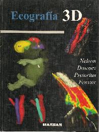 Ecografa 3D