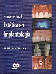 Fundamentos de Esttica en Implantologa