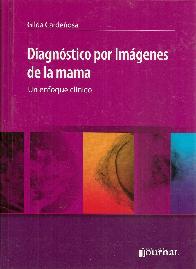 Diagnstico por imagenes de la mama