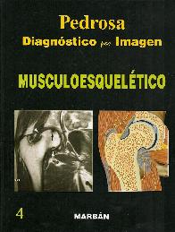 Pedrosa Diagnóstico por Imagen Musculoesquelético 4