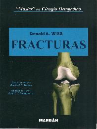 Fracturas