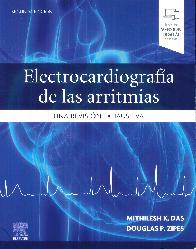 Electrocardiografa de las arritmias