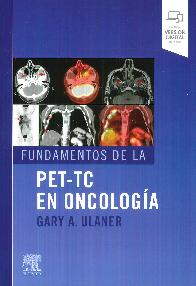 Fundamentos de la PET-TC en oncologa