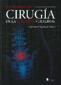 Controversias en la ciruga de la columna vertebral