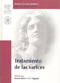 Dermatologia Estetica Tratamiento de las Varices