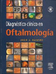 Diagnostico clinico en Oftalmologia 